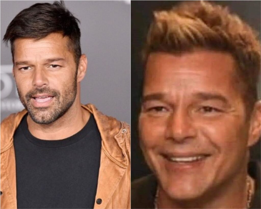 Ricky-Martin